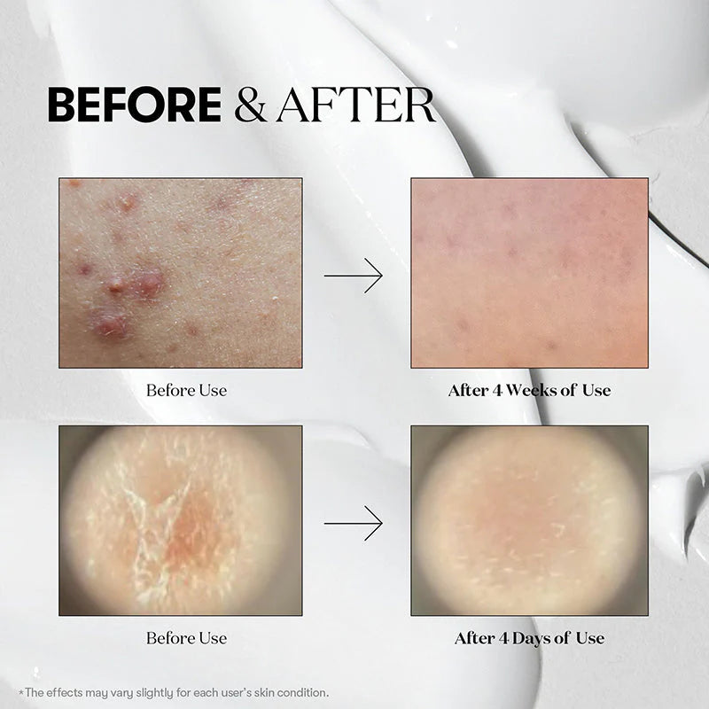 VT Cosmetics Reedle Shot 300 Stick Pouch | Booster de Microagulhas — imagem 4
