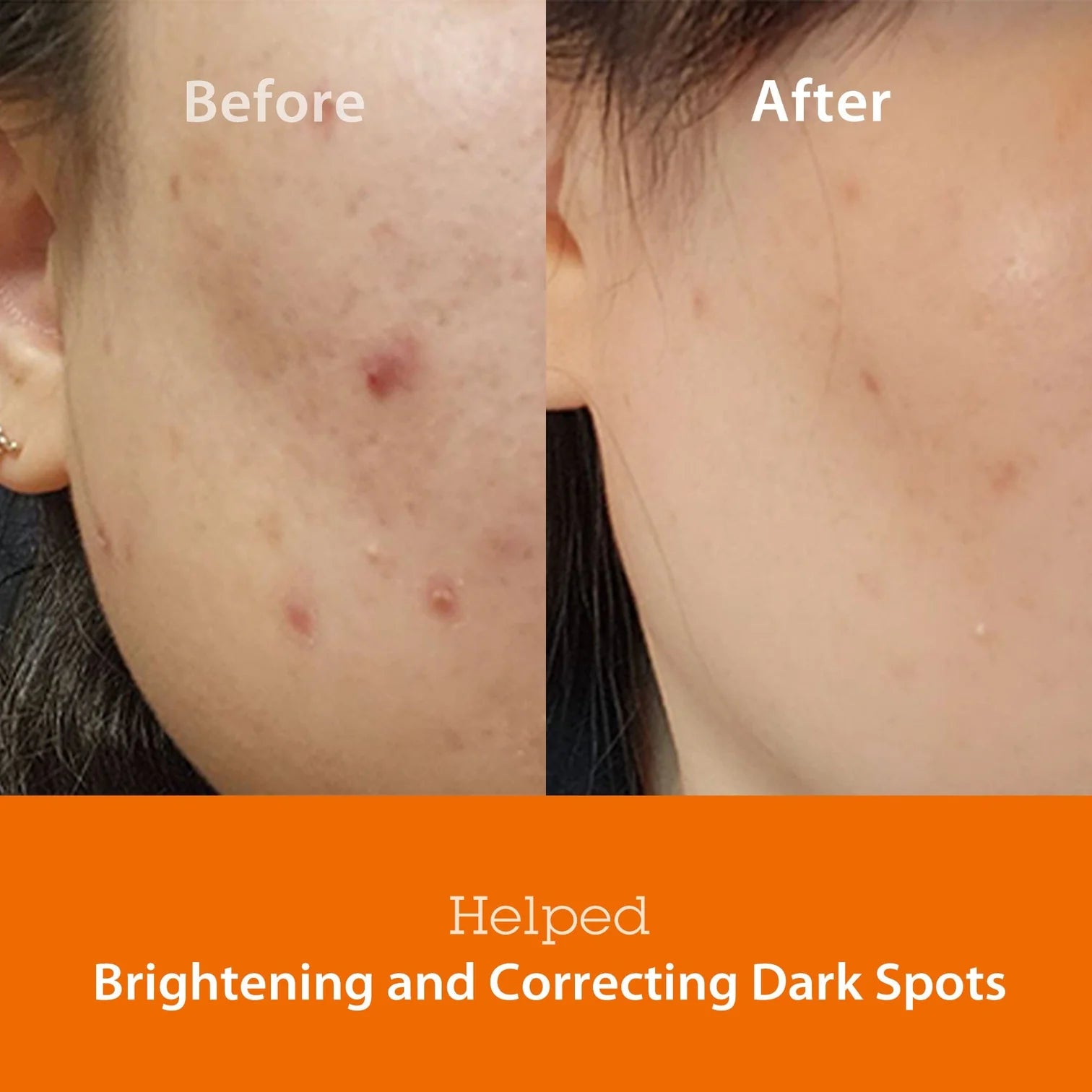 Blithe Targeted Blemish Serum Tranexamic Acid 3.0 — imagem 4