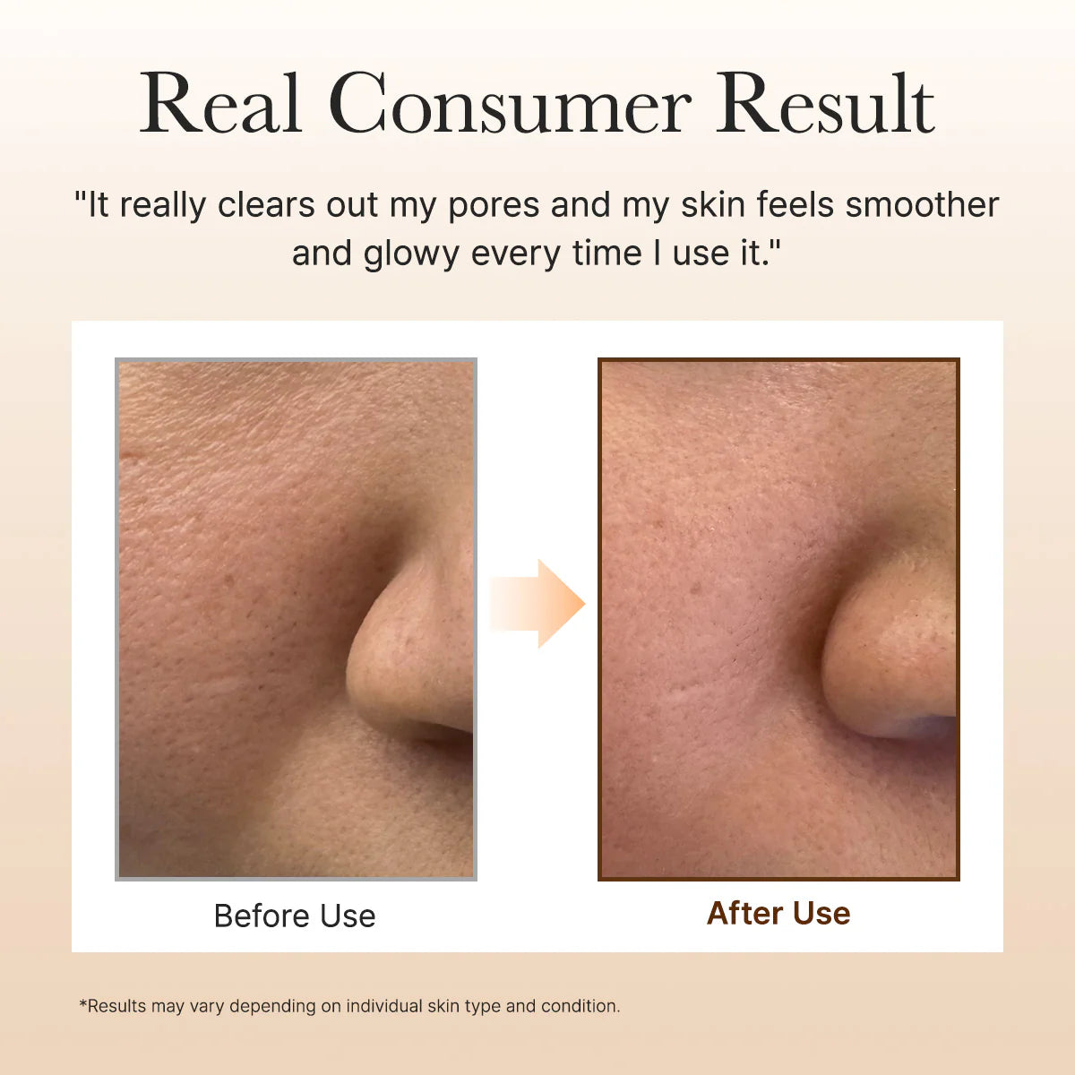 Arencia Calendula Rice Mochi Cleanser — Gel de Limpeza K-Beauty — imagem 6