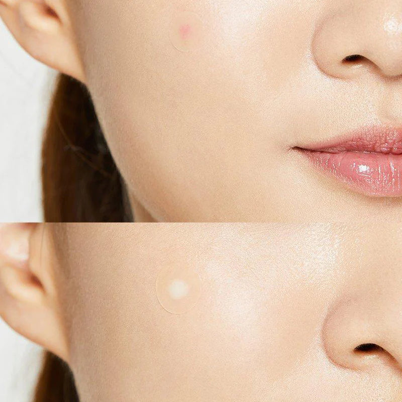 COSRX Acne Pimple Master Patch Original Fit – Patches Hidrocolóide — imagem 6