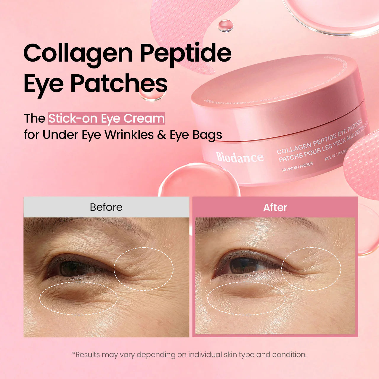 Biodance Collagen Peptide Eye Patches com colagénio de baixo peso molecular, formato hidrogel